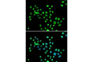 Immunofluorescence analysis of U2OS cells using macroH2A. (H2AFY anticorps  (AA 123-372))
