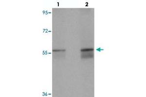 Western blot analysis of NETO1 in human lung tissue with NETO1 polyclonal antibody  at (lane 1) 1 and (lane 2) 2 ug/mL. (NETO1 anticorps  (C-Term))