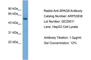 WB Suggested Anti-SPAG6  Antibody Titration: 0. (SPAG6 anticorps  (Middle Region))