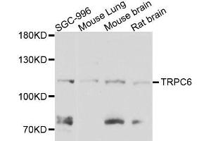Western blot analysis of extracts of various cell lines, using TRPC6 antibody. (TRPC6 anticorps  (AA 500-600))