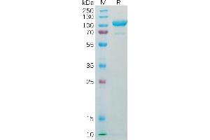 Human AFP Protein, hFc Tag on SDS-PAGE under reducing condition.