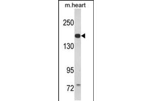 Western blot analysis of CORIN Antibody in mouse heart tissue lysates (35ug/lane) (Corin anticorps  (AA 459-490))