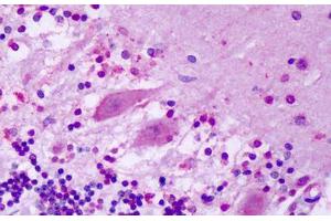 Anti-GPR1 antibody IHC staining of human brain, cerebellum, purkinje neurons. (G Protein-Coupled Receptor 1 anticorps  (N-Term))
