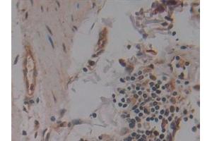 Detection of NUP155 in Human Colon Tissue using Polyclonal Antibody to Nucleoporin 155 (NUP155)