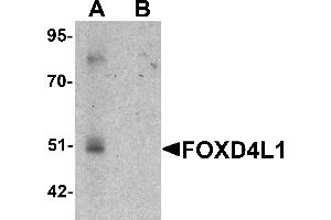 Western blot analysis of FOXD4L1 in A-20 cell lysate with FOXD4L1 antibody at 1 µg/mL in (A) the absence and (B) the presence of blocking peptide. (FOXD4L1 anticorps  (C-Term))