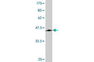 Western Blot detection against Immunogen (45.