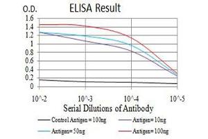 Black line: Control Antigen (100 ng),Purple line: Antigen (10 ng), Blue line: Antigen (50 ng), Red line:Antigen (100 ng) (SMARCA1 anticorps  (AA 933-1070))