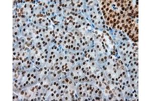 Immunohistochemical staining of paraffin-embedded colon tissue using anti-MCL1 mouse monoclonal antibody. (MCL-1 anticorps)