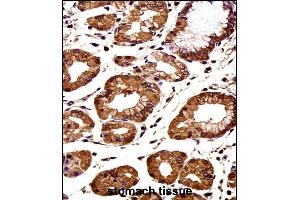CTNNB1 Antibody (C-term) immunohistochemistry analysis in formalin fixed and paraffin embedded human stomach tissue followed by peroxidase conjugation of the secondary antibody and DAB staining. (CTNNB1 anticorps  (C-Term))