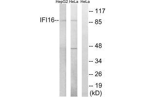 Western blot analysis of extracts from HeLa cells and HepG2 cells, using IFI16 antibody. (IFI16 anticorps  (C-Term))