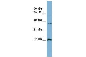 Ran antibody used at 1 ug/ml to detect target protein. (RAN anticorps  (Middle Region))