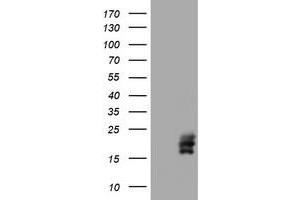 Image no. 1 for anti-Chorionic Gonadotropin, beta Polypeptide (CGB) (AA 21-165) antibody (ABIN1491188) (CGB anticorps  (AA 21-165))
