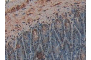 Detection of CPB2 in Mouse Intestine Tissue using Polyclonal Antibody to Carboxypeptidase B2 (CPB2)