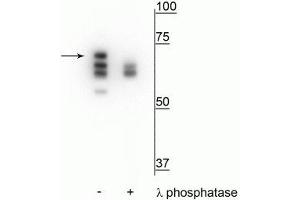 Western blot of T47D cell lysate treated with EGF (1 nM) for 60 minutes showing specific labeling of the ~70 kDa Hsp70 in the first lane (-). (HSP70 1A anticorps  (pThr153))