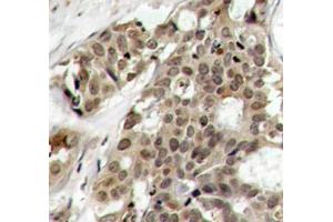 Immunohistochemistry (IHC) image for anti-Mitogen-Activated Protein Kinase 3 (MAPK3) (pTyr204) antibody (ABIN3019890)