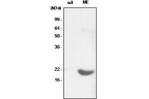 Recombinant crystallin alpha A (alphaA) and the extract of mouse eye (ME) were resolved by SDS-PAGE, transferred to PVDF membrane and probed with anti-human crystallin alpha B antibody (1:1,000). (CRYAB anticorps  (AA 1-175))