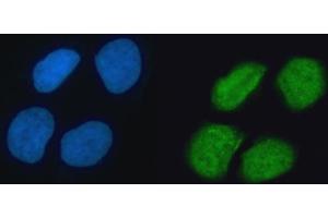IF analysis of hnRNP K/HNRNPK using anti-hnRNP K/HNRNPK antibody (ABIN7601650). (HNRNPK anticorps  (AA 40-463))