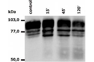 Western Blotting analysis of PMA-activated neutrophils (Fig. (Integrin beta 2 anticorps)
