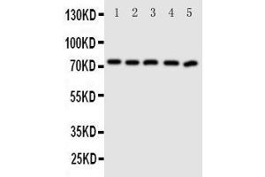 Western Blotting (WB) image for anti-ATP-Binding Cassette, Sub-Family G (WHITE), Member 5 (ABCG5) (AA 116-131), (N-Term) antibody (ABIN3044097) (ABCG5 anticorps  (N-Term))
