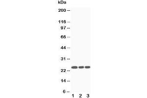 Western blot testing of SOCS3 antibody and Lane 1:  Jurkat;  2: CEM;  3: Raji cell lysate (SOCS3 anticorps  (Middle Region))