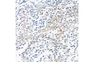 Immunohistochemistry of paraffin-embedded human tonsil using HSD17B10 antibody.