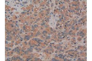 Detection of aZGP1 in Human Prostate Tissue using Polyclonal Antibody to Alpha-2-Glycoprotein 1, Zinc Binding (aZGP1)