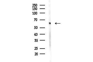 anti-NOP58 Ribonucleoprotein (NOP58) (Internal Region) antibody