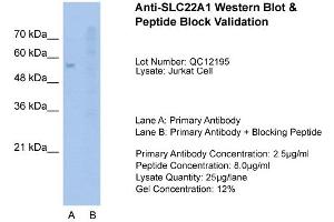 Host:  Rabbit  Target Name:  SLC22A1  Sample Type:  Jurkat  Lane A:  Primary Antibody  Lane B:  Primary Antibody + Blocking Peptide  Primary Antibody Concentration:  2.