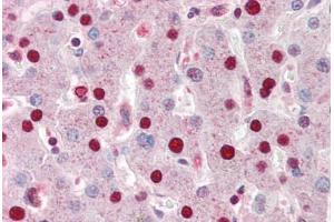 Human Liver (formalin-fixed, paraffin-embedded) stained with ANP32A antibody ABIN461885 at 5 ug/ml followed by biotinylated goat anti-rabbit IgG secondary antibody ABIN481713, alkaline phosphatase-streptavidin and chromogen.