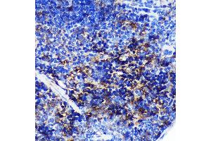 Immunohistochemistry of paraffin-embedded Mouse spleen using SW Rabbit pAb (ABIN7270654) at dilution of 1:100 (40x lens).
