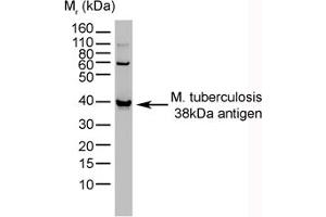 Image no. 1 for anti-Mycobacterium Tuberculosis, 38kDa antibody (ABIN304017) (Mycobacterium Tuberculosis, 38kDa anticorps)