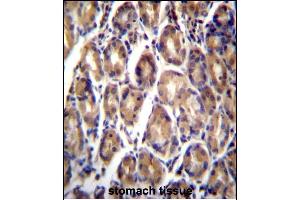 RARRES1 Antibody (C-term) (ABIN657062 and ABIN2846226) immunohistochemistry analysis in formalin fixed and paraffin embedded human stomach tissue followed by peroxidase conjugation of the secondary antibody and DAB staining. (RARRES1 anticorps  (C-Term))