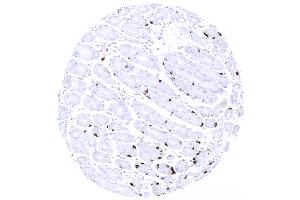 Strong chromogranin A expression in scattered neuroendocrine cells of stomach antrum glands