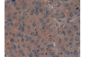 anti-Ribonuclease/angiogenin Inhibitor 1 (RNH1) (AA 218-444) antibody