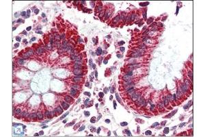 Human Colon (formalin-fixed, paraffin-embedded) stained with TSPOat 2. (TSPO anticorps  (C-Term))