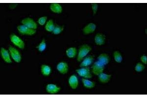Immunofluorescent analysis of MCF-7 cells using ABIN7151962 at dilution of 1:100 and Alexa Fluor 488-congugated AffiniPure Goat Anti-Rabbit IgG(H+L) (EPN3 anticorps  (AA 25-208))