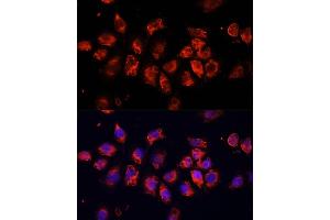 Immunofluorescence analysis of HeLa cells using SMO Polyclonal Antibody (ABIN6130715, ABIN6148140, ABIN6148141 and ABIN6220185) at dilution of 1:100 (40x lens). (SMO anticorps  (AA 554-787))