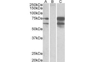 HEK293 lysate (10ug protein in RIPA buffer) overexpressing Human NRXN1 with DYKDDDDK tag probed with ABIN2564097 (0. (Neurexin 1 anticorps  (C-Term))