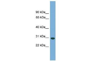 Carbonic Anhydrase Vb antibody (Mitochondrial) used at 1 ug/ml to detect target protein. (CA5B anticorps  (N-Term))
