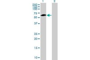 Western Blot analysis of EVC expression in transfected 293T cell line by EVC MaxPab polyclonal antibody. (EVC anticorps  (AA 1-535))