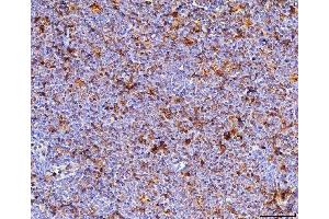 IHC analysis of Cd70 using anti-Cd70 antibody (ABIN7601463). (CD70 anticorps  (AA 36-191))