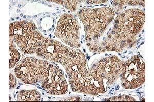 Immunohistochemical staining of paraffin-embedded Human Kidney tissue using anti-ALDOB mouse monoclonal antibody. (ALDOB anticorps)