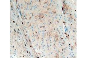 IHC-P analysis of Mouse Brain Tissue, with DAB staining. (S100B anticorps  (AA 1-92))