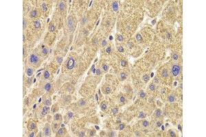 Immunohistochemistry of paraffin-embedded Human liver damage using PEX5 Polyclonal Antibody at dilution of 1:100 (40x lens). (PEX5 anticorps)