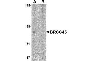 Western blot analysis of BRCC45 in HeLa cell lysate in (A) the absence and (B) presence of blocking peptide with AP30165PU-N BRCC45 antibody at 1 μg/ml. (BRE anticorps  (N-Term))