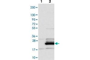 Western blot analysis of Lane 1: Negative control (vector only transfected HEK293T lysate). (FAM96B anticorps)