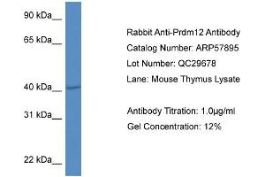 Western Blotting (WB) image for anti-PR Domain Containing 12 (PRDM12) (Middle Region) antibody (ABIN2787445) (PRDM12 anticorps  (Middle Region))