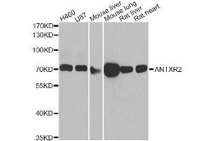 Western blot analysis of extracts of various cell lines, using ANTXR2 antibody. (ANTXR2 anticorps  (AA 339-488))