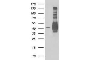 Western Blotting (WB) image for anti-Microtubule-Associated Protein, RP/EB Family, Member 2 (MAPRE2) antibody (ABIN1499321) (MAPRE2 anticorps)