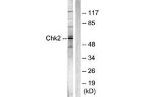 Western blot analysis of extracts from Jurkat cells, using Chk2 (Ab-387) Antibody. (CHEK2 anticorps  (AA 361-410))